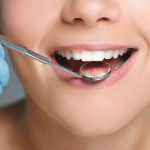 How to Find a Good Dental Implant Specialist
